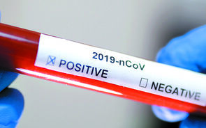 Portugal com mais 79 mortes por covid-19 e 5.891 novos infetados